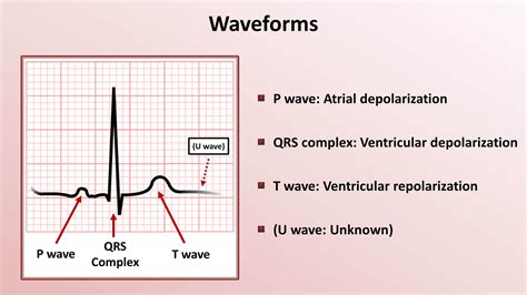 Introduction to ECG Interpretation – Cardiovascular Education.